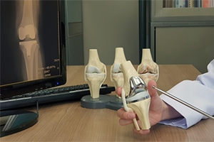 The ElyMethod™: A Complete Approach to Knee Replacement- Before, During, and after Surge...