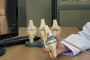 Understanding the Difference between Total and Partial Knee Replacement