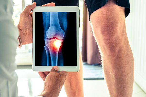 How Do You Find the Best Knee Surgeon in Michigan for Your Knee Pain?