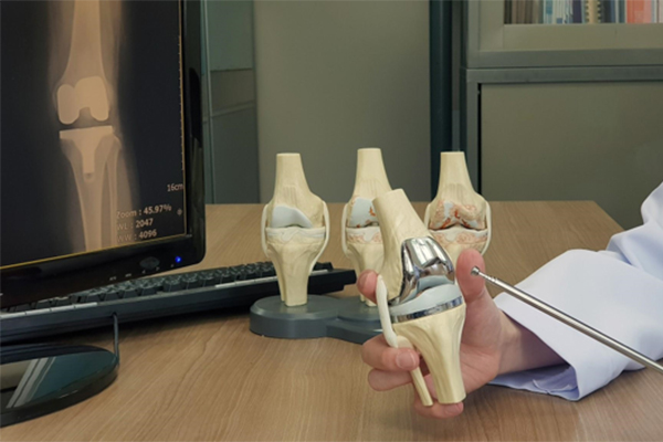 The ElyMethod™: A Complete Approach to Knee Replacement- Before, During, and after Surgery